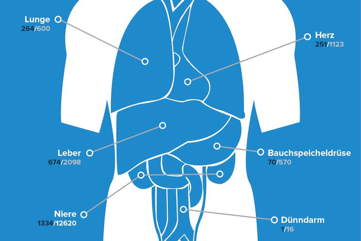 Organspende: Angebot und Nachfrage